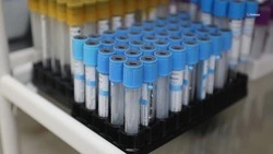 Проверяться на гепатит C нужно ежегодно — минздрав Ставрополья  